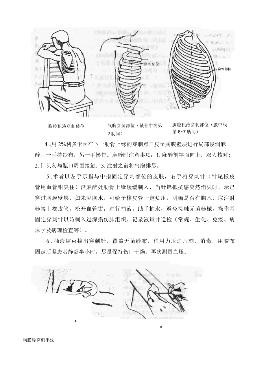 四大穿刺技术操作规范.docx_第2页