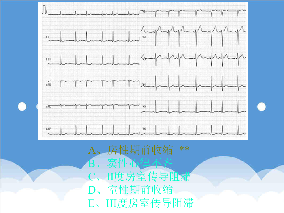 管理制度-规范化培训之辅助检查结果判读 精品.ppt_第3页