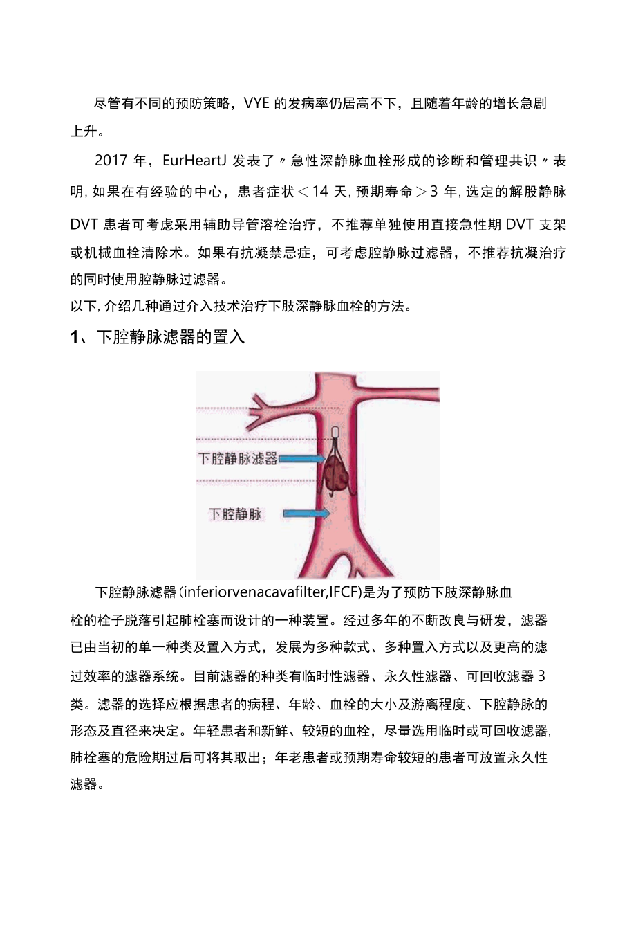 介入技术在下肢深静脉血栓治疗中的应用.docx_第2页