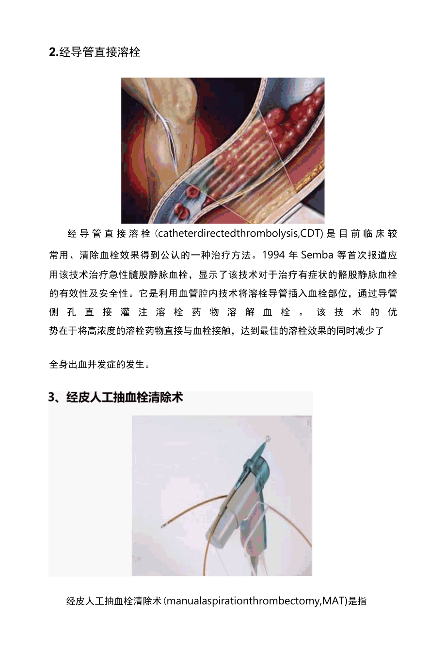 介入技术在下肢深静脉血栓治疗中的应用.docx_第3页