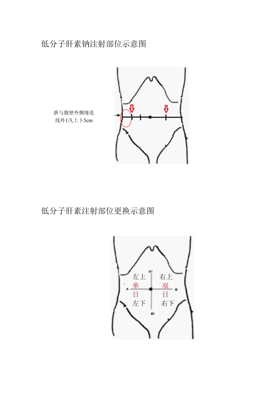 低分子肝素皮下注射的标准化操作流程.docx_第2页