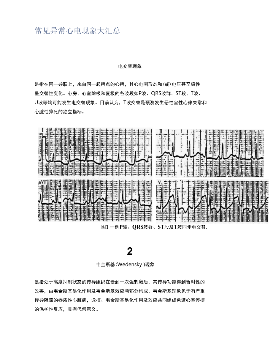 常见异常心电现象大汇总.docx_第1页