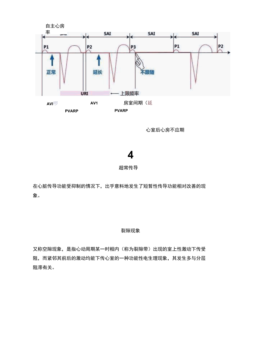 常见异常心电现象大汇总.docx_第3页