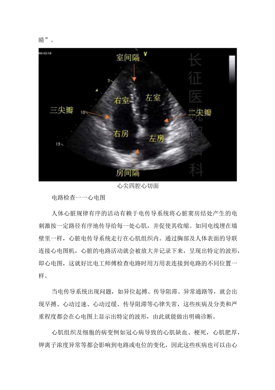 心内科常用各项心脏检查方法检查内容和目的.docx_第3页