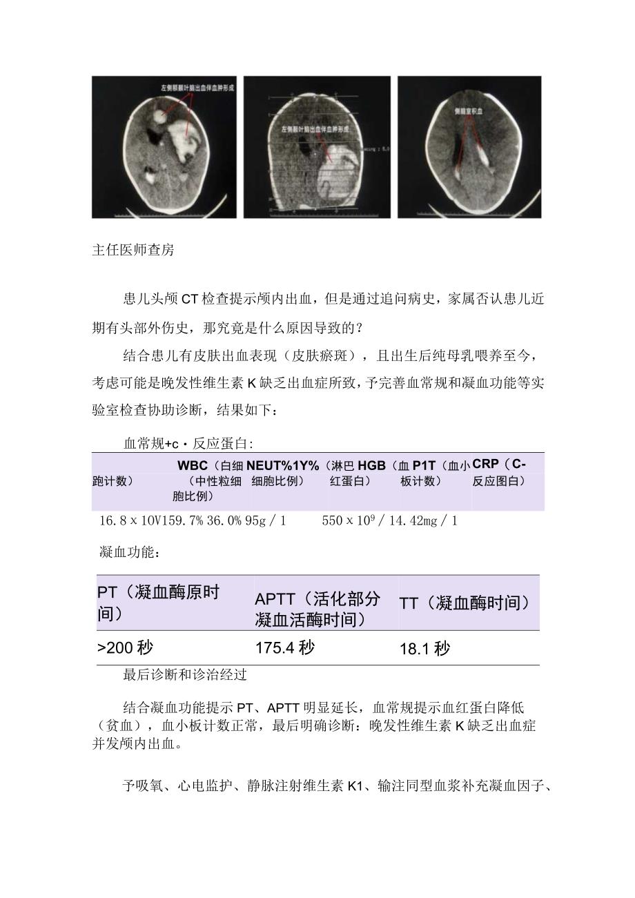 幼儿晚发性维生素K缺乏出血症病例分享疾病病因发病机制临床表现实验室检查鉴别诊断诊断标准及治疗措施.docx_第2页