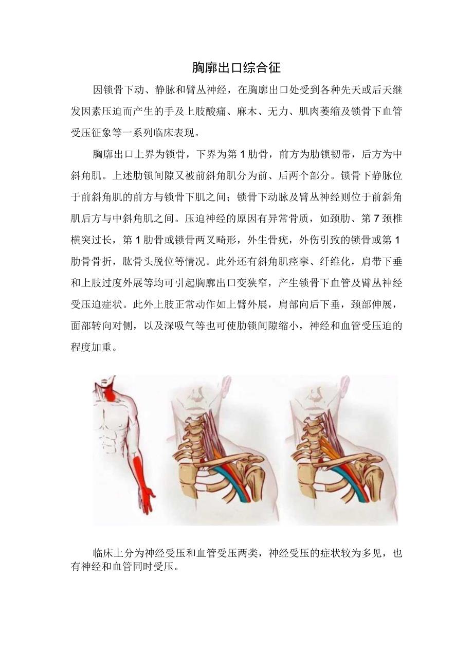 神经根型颈椎病胸廓出口综合征脑中风末梢神经炎血管因素冈下肌疼痛综合症糖尿病更年期综合征中毒等疾病手麻症状疾病高发.docx_第2页