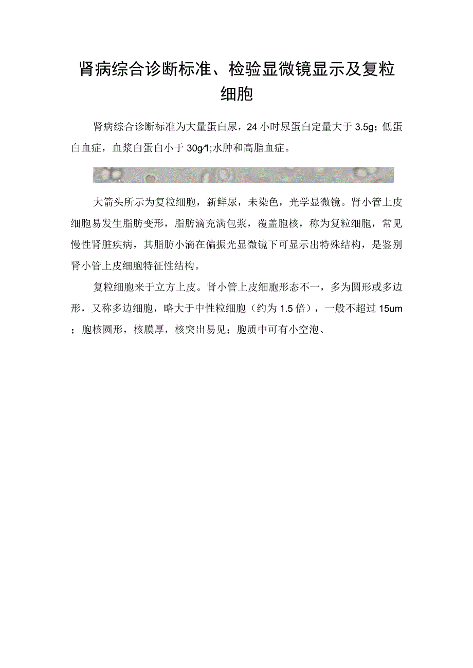 肾病综合诊断标准检验显微镜显示及复粒细胞.docx_第1页