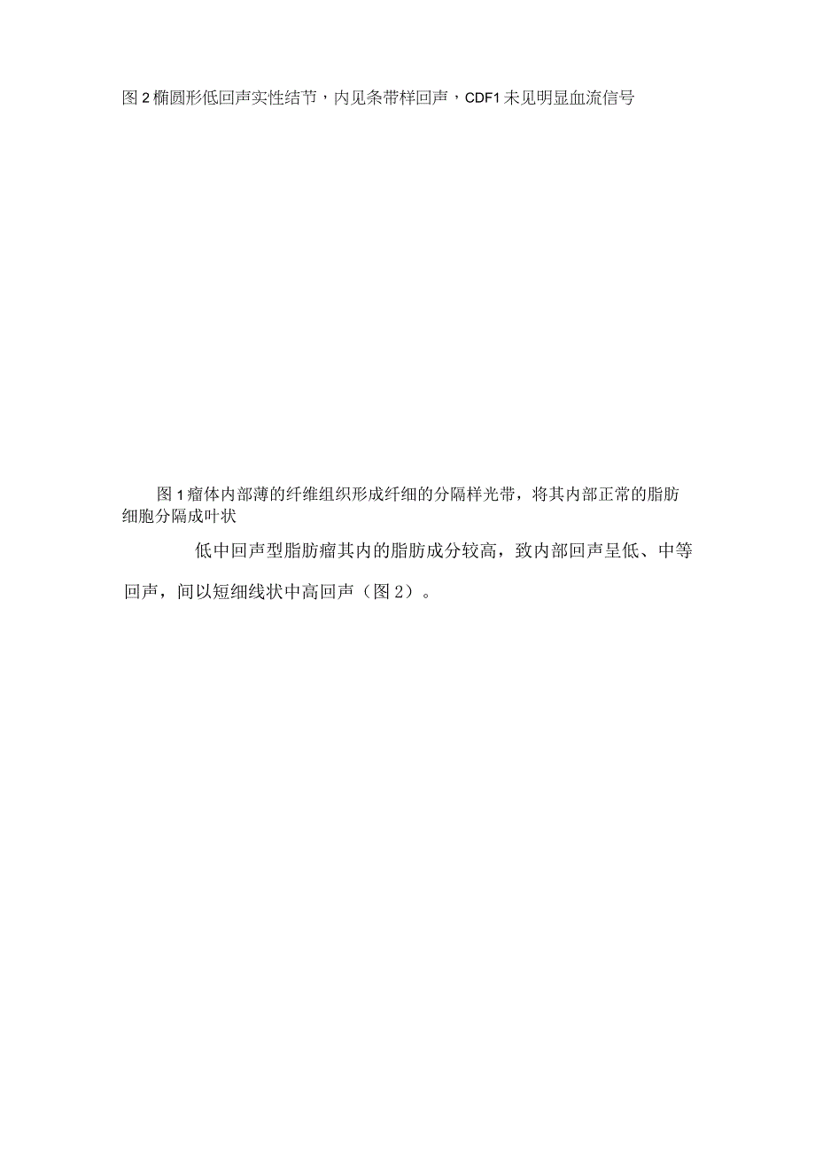 脂肪瘤疾病发病机制高发年龄常见部位超声表现及与脂肪肉瘤鉴别诊断.docx_第2页