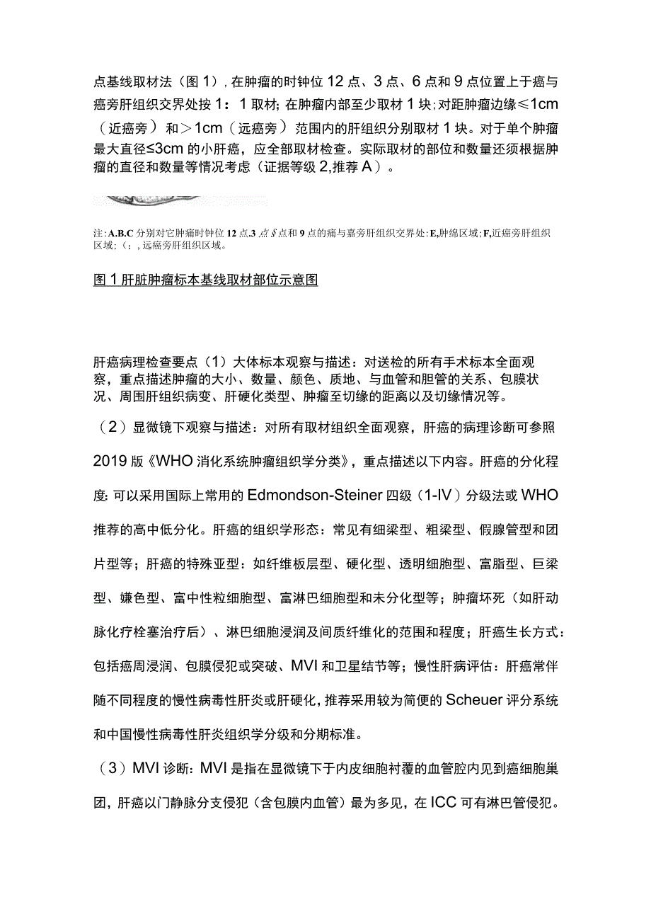 2023原发性肝癌的诊断及分期完整版.docx_第3页