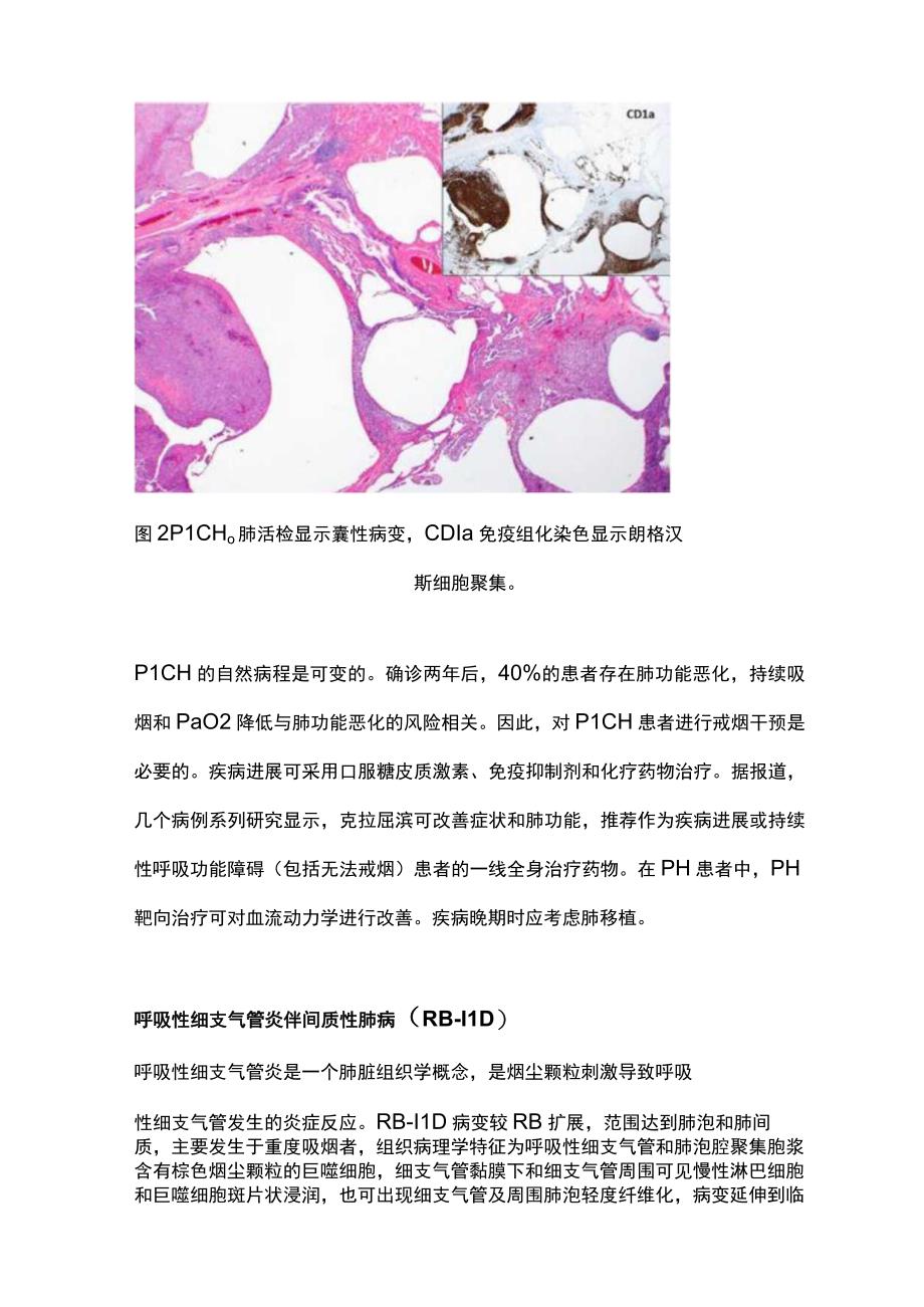 2023吸烟相关间质性肺疾病的临床表现诊断及治疗完整版.docx_第3页