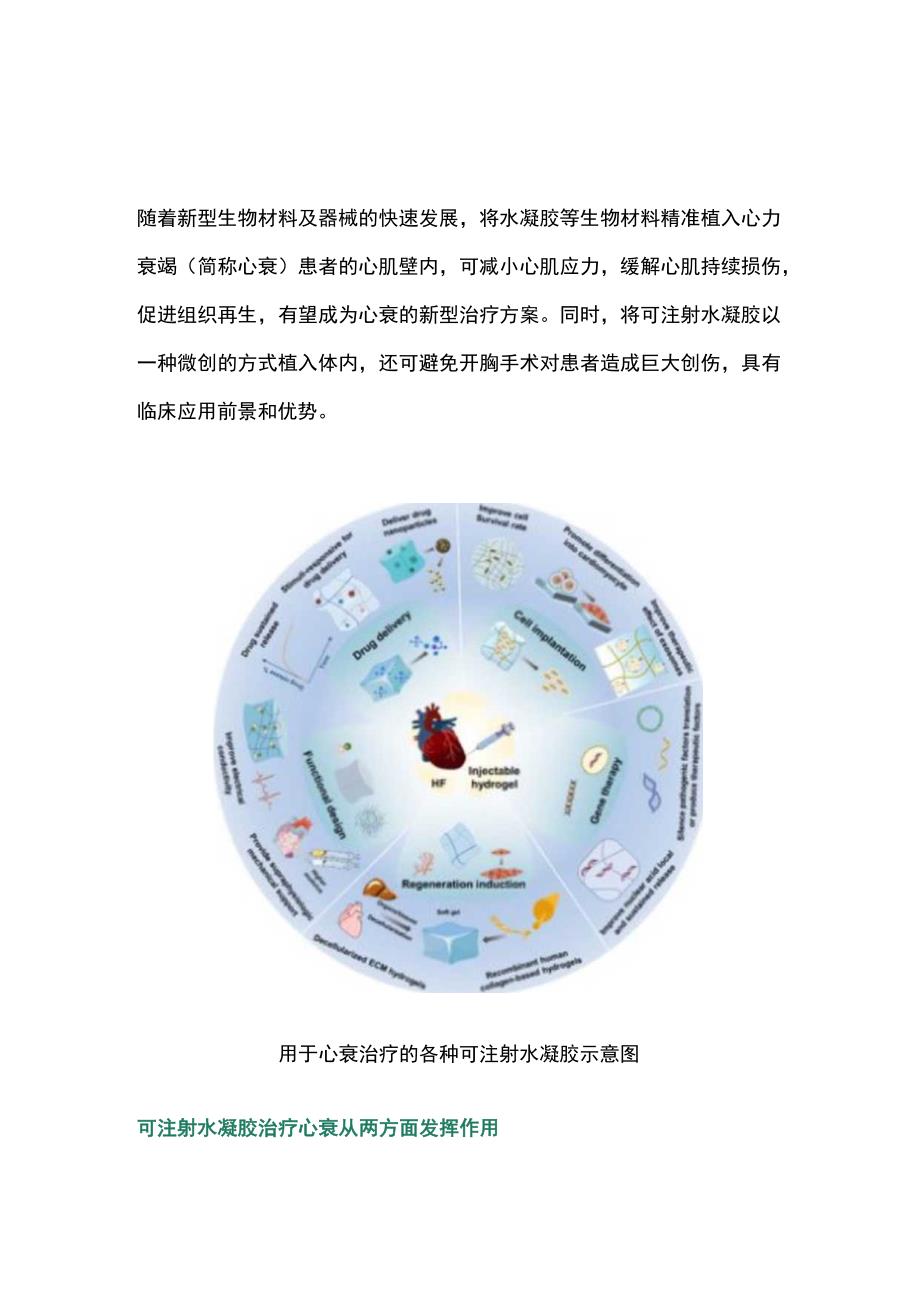 2023可注射水凝胶或成心衰治疗新方案全文.docx_第1页