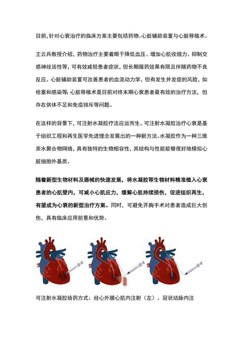 2023可注射水凝胶或成心衰治疗新方案全文.docx_第2页