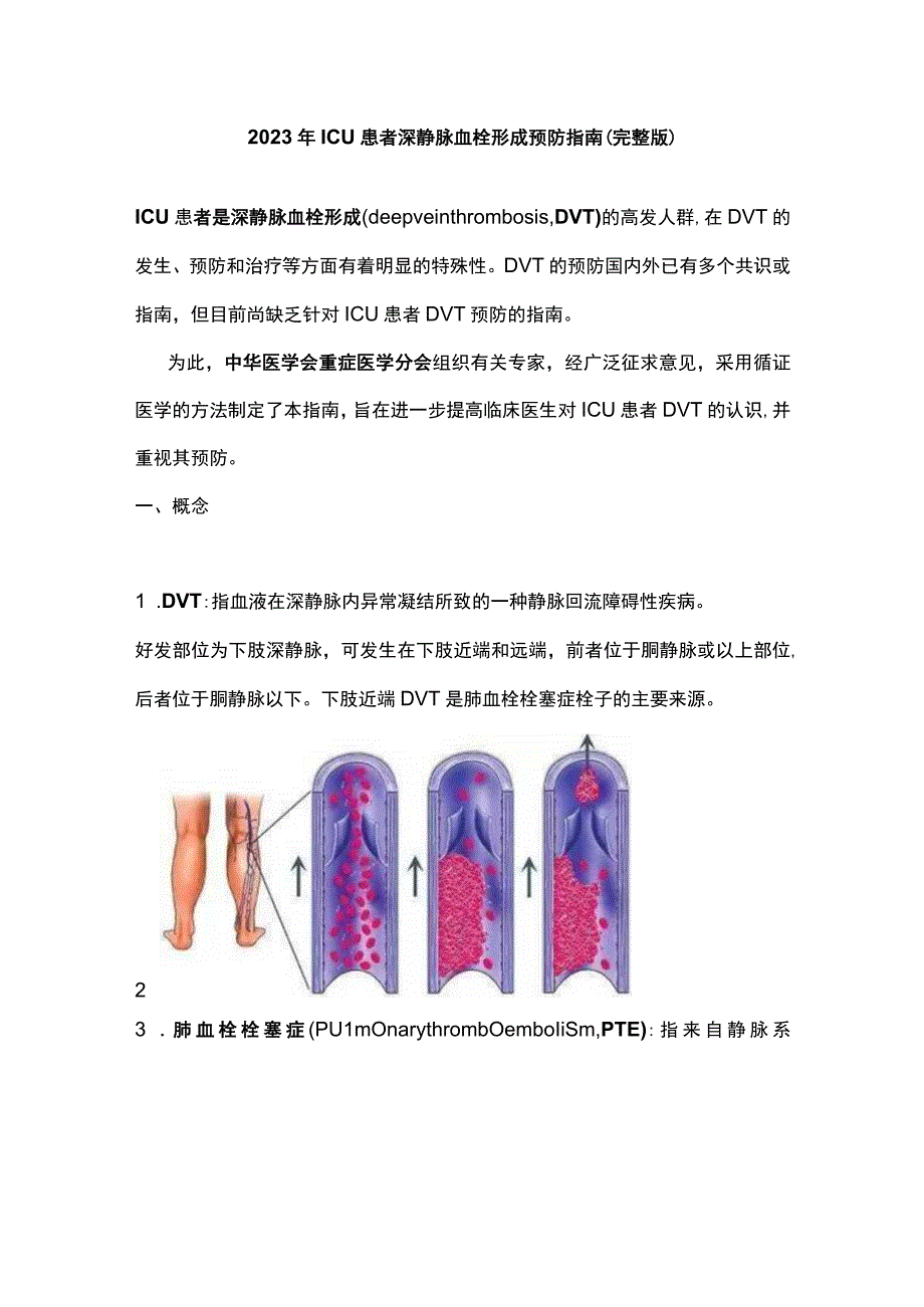 2023年ICU患者深静脉血栓形成预防指南完整版.docx_第1页