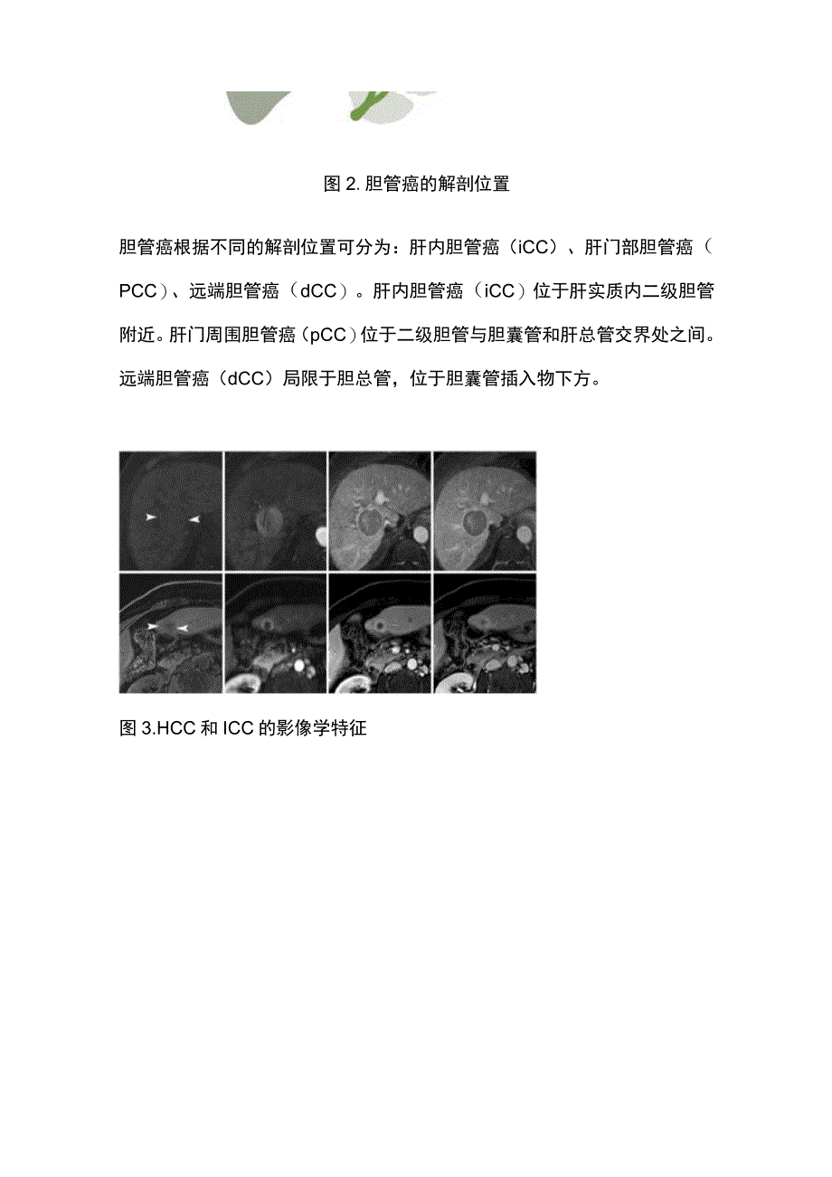 2023肝内胆管癌治疗进展：临床医生当前和未来治疗前景概述.docx_第3页