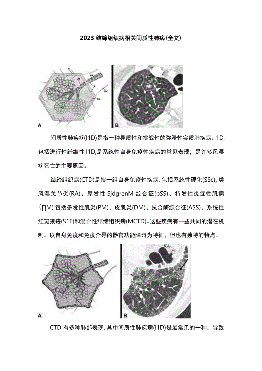 2023结缔组织病相关间质性肺病全文.docx_第1页