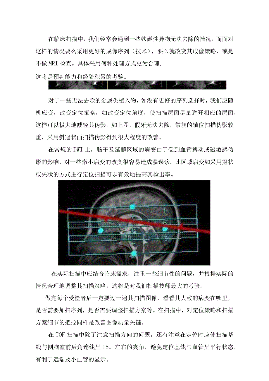 MRI扫描中准备工作定位策略细节扫描参数细节序列细节等注意事项.docx_第2页