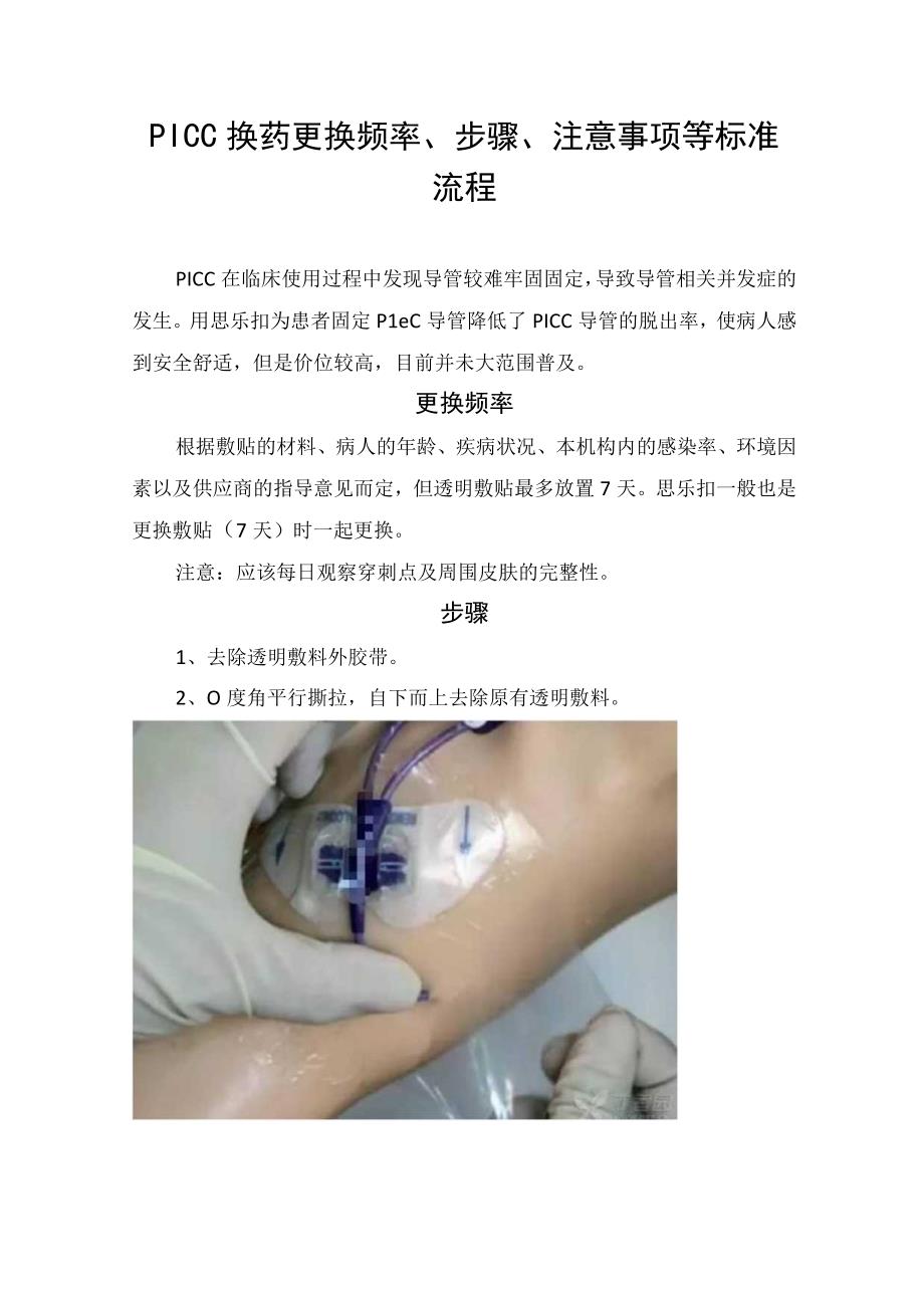 PICC换药更换频率步骤注意事项等标准流程.docx_第1页