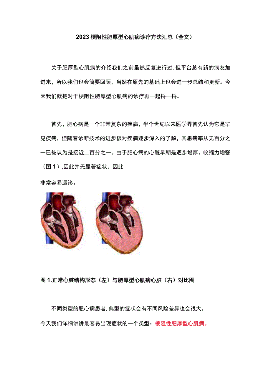 2023梗阻性肥厚型心肌病诊疗方法汇总全文.docx_第1页