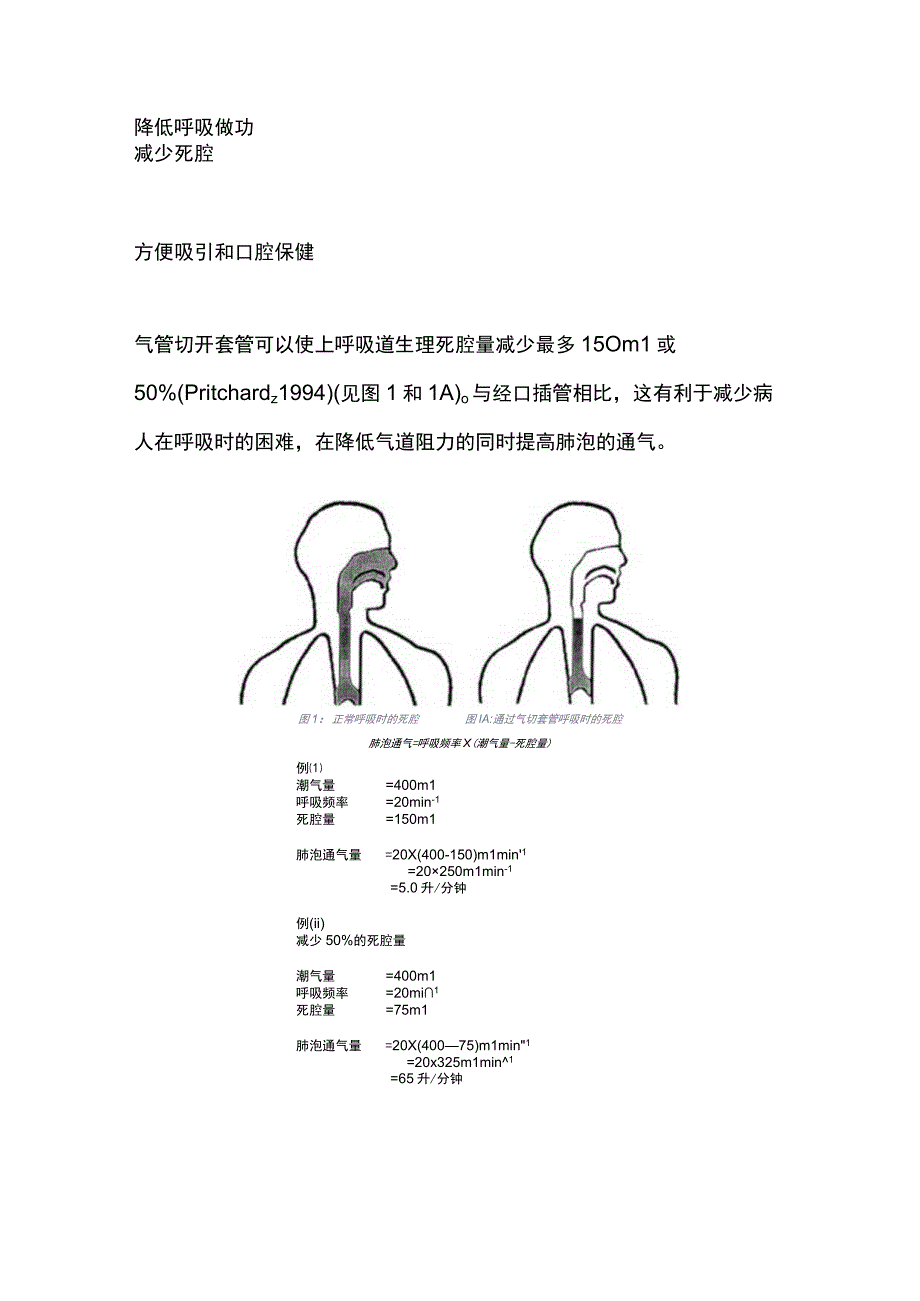 2023气管切开和经皮气管切开术全文.docx_第2页