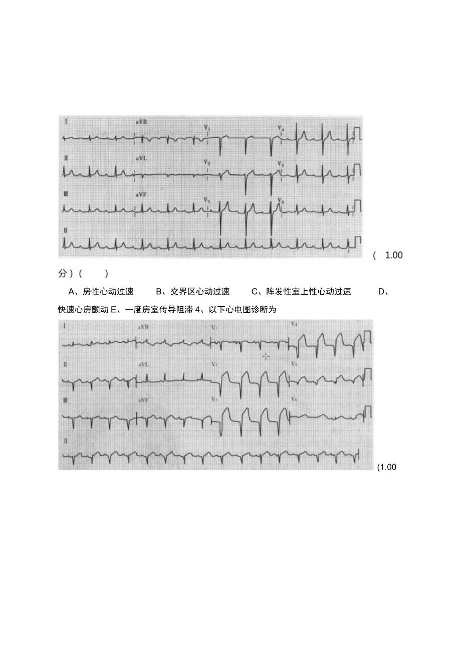 住院医师规范化培训(心电图识别专项练习).docx_第2页