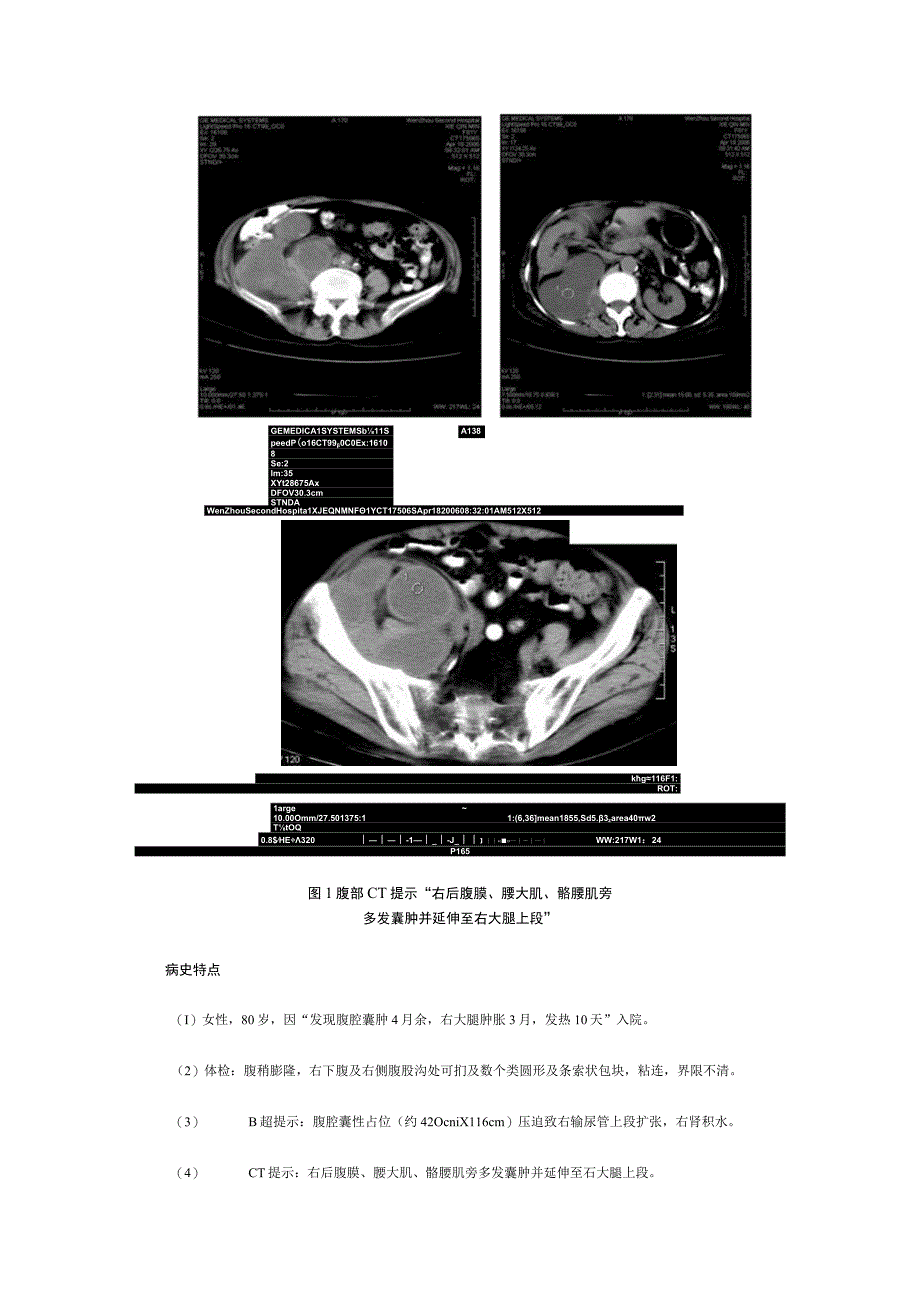 实用临床基础课程病例模板1.docx_第2页