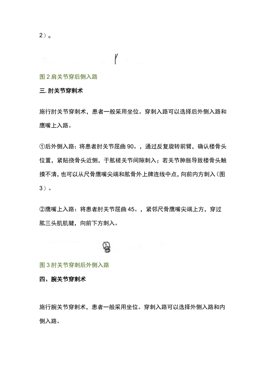 最新：各关节穿剌术的技巧及注意事项.docx_第3页