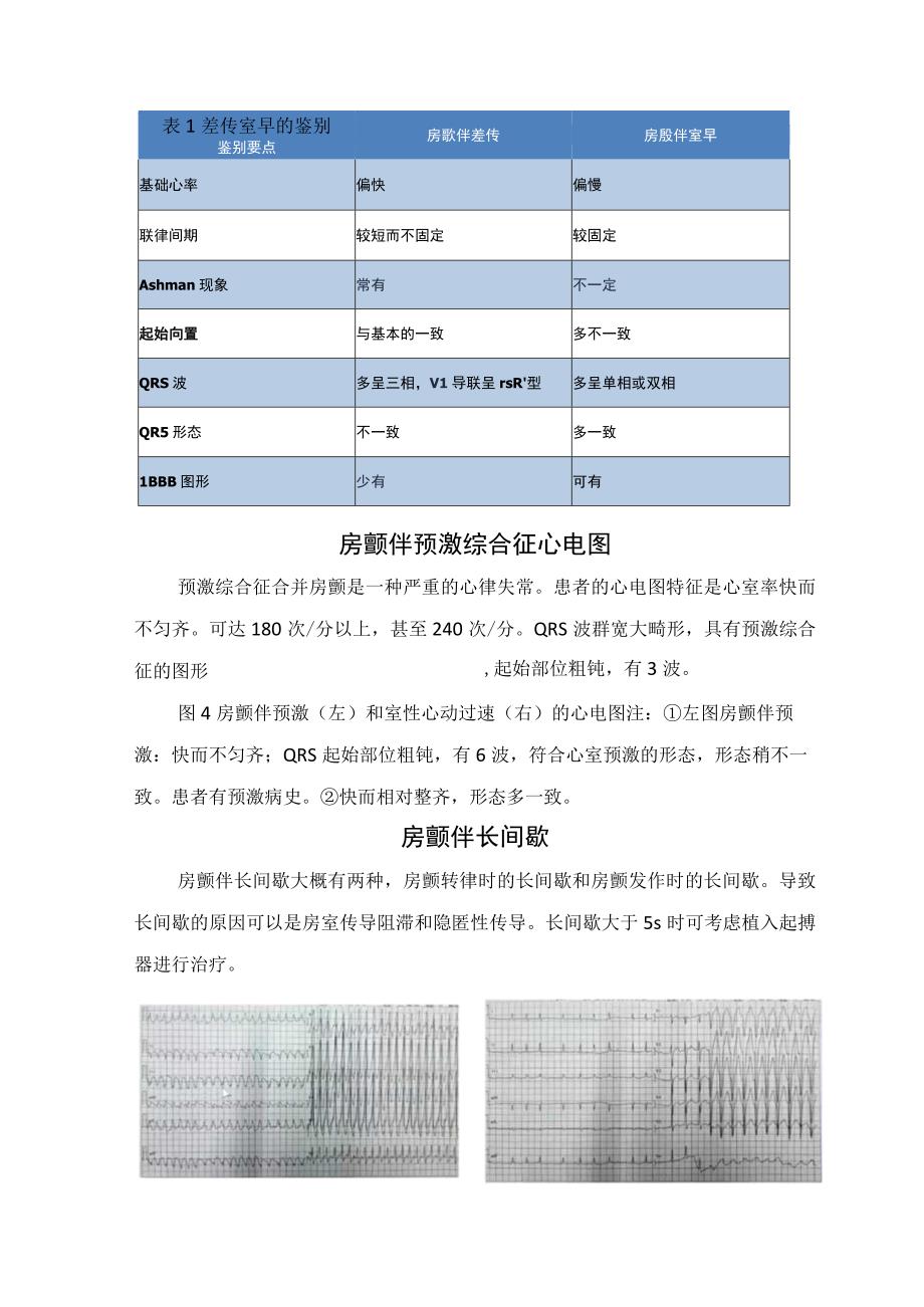 房颤心电图特征及房颤伴房室传导阻滞房颤伴差异性传导房颤伴预激综合征房颤伴长间歇等特殊心电图表现和要点总结.docx_第3页