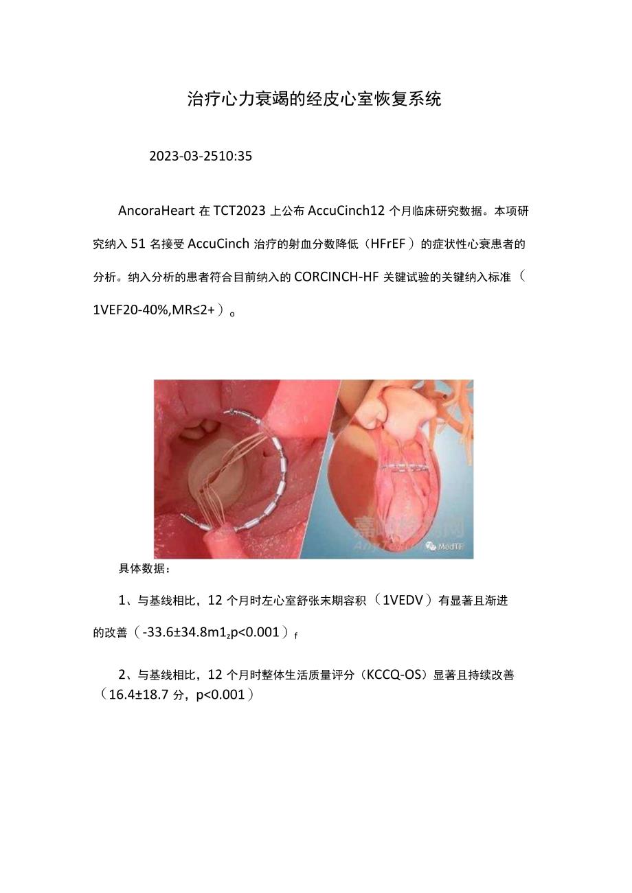 治疗心力衰竭的经皮心室恢复系统.docx_第1页