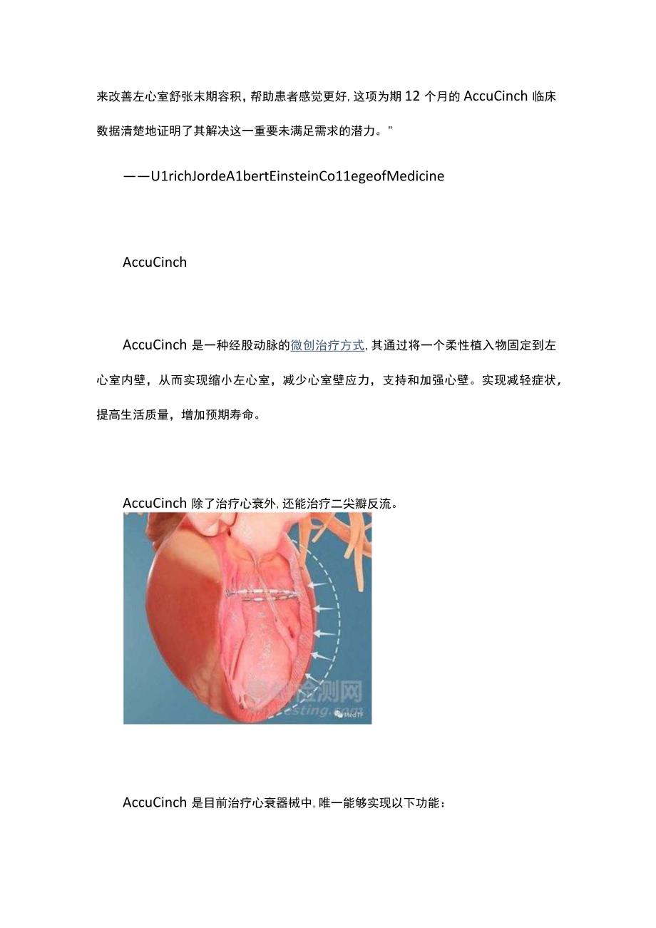 治疗心力衰竭的经皮心室恢复系统.docx_第3页