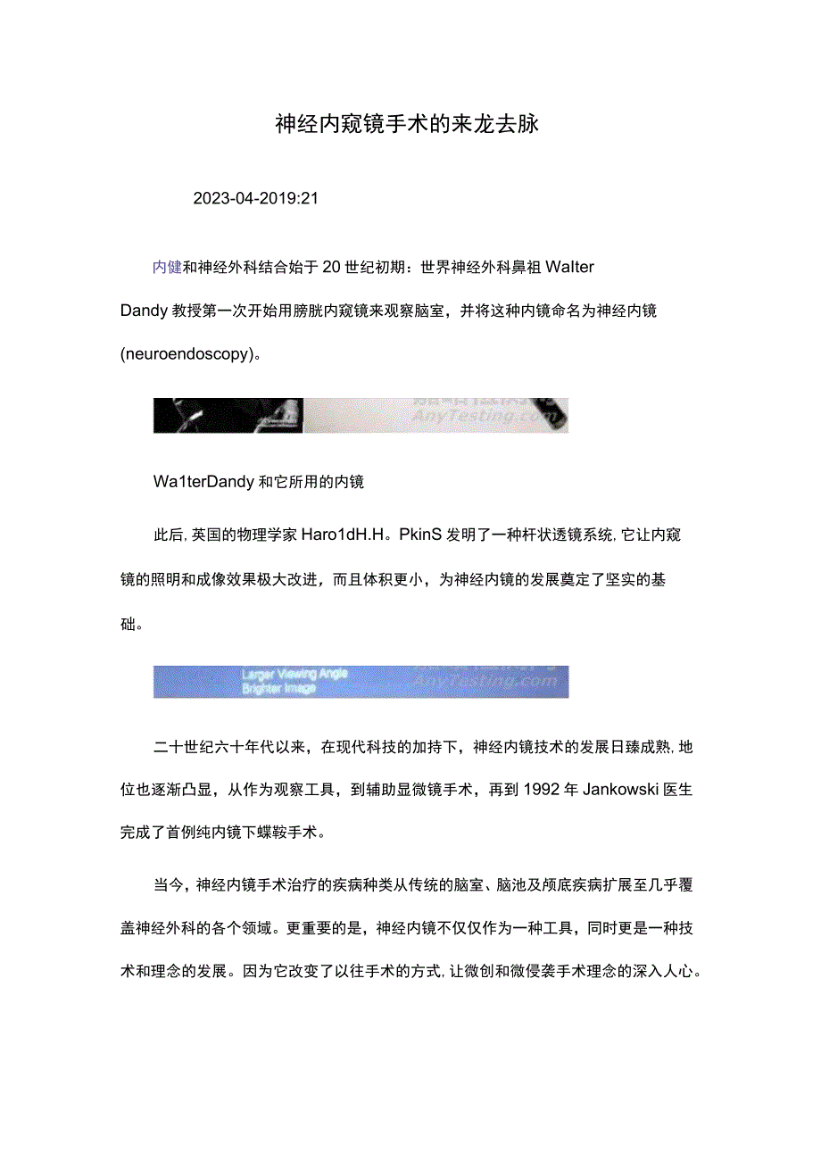 神经内窥镜手术的来龙去脉.docx_第1页