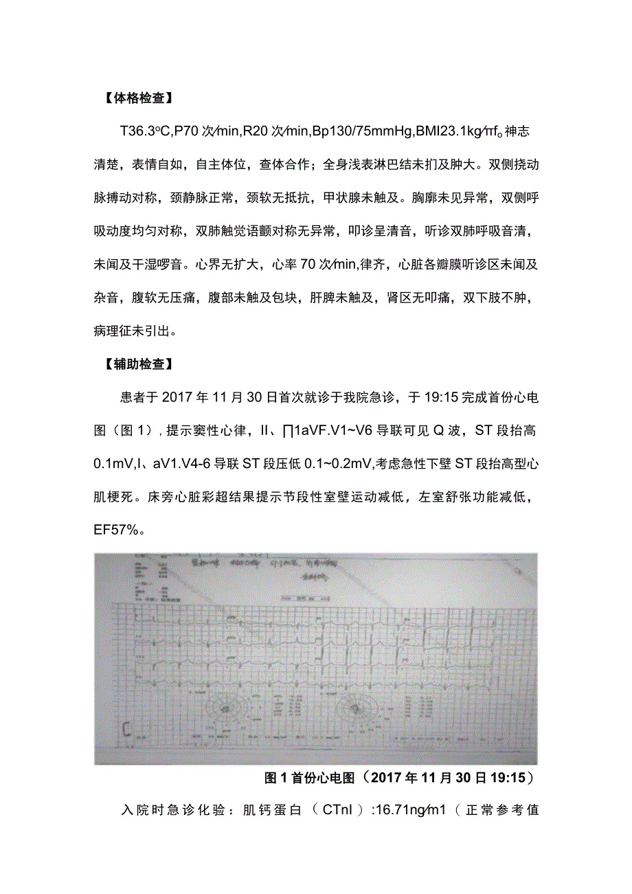 2023高血栓负荷患者冠脉内溶栓病例.docx_第2页