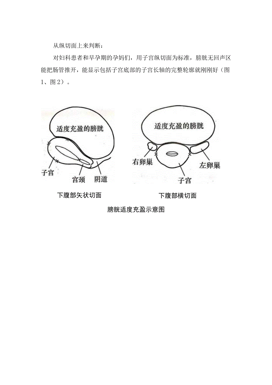 临床经腹部扫查女性生殖器检查前准备 检查方法及判断要点.docx_第2页