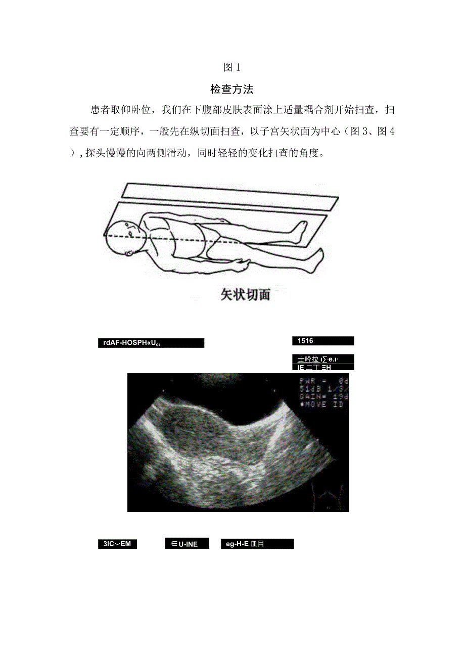 临床经腹部扫查女性生殖器检查前准备 检查方法及判断要点.docx_第3页