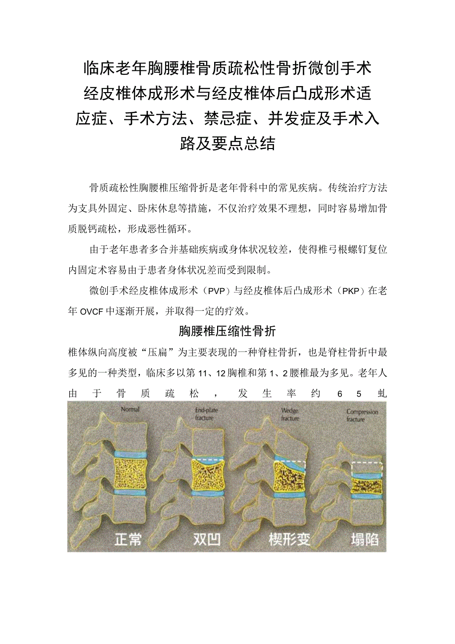 临床老年胸腰椎骨质疏松性骨折微创手术经皮椎体成形术与经皮椎体后凸成形术适应症手术方法禁忌症并发症及手术入路及要点总结.docx_第1页