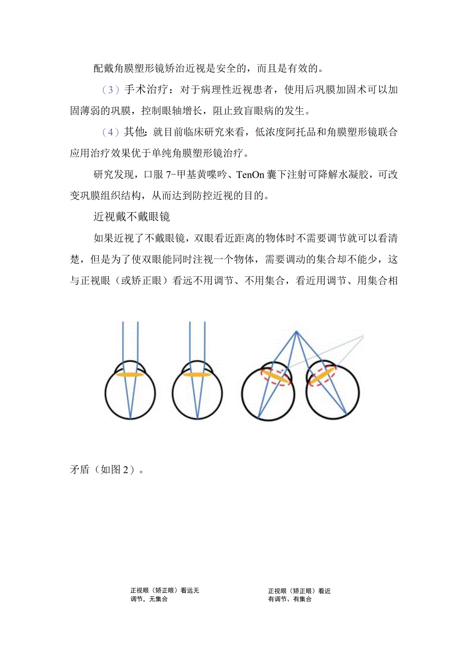 儿童近视发展趋势正常视力标准诊断要点原因分析治疗措施及预防措施.docx_第3页