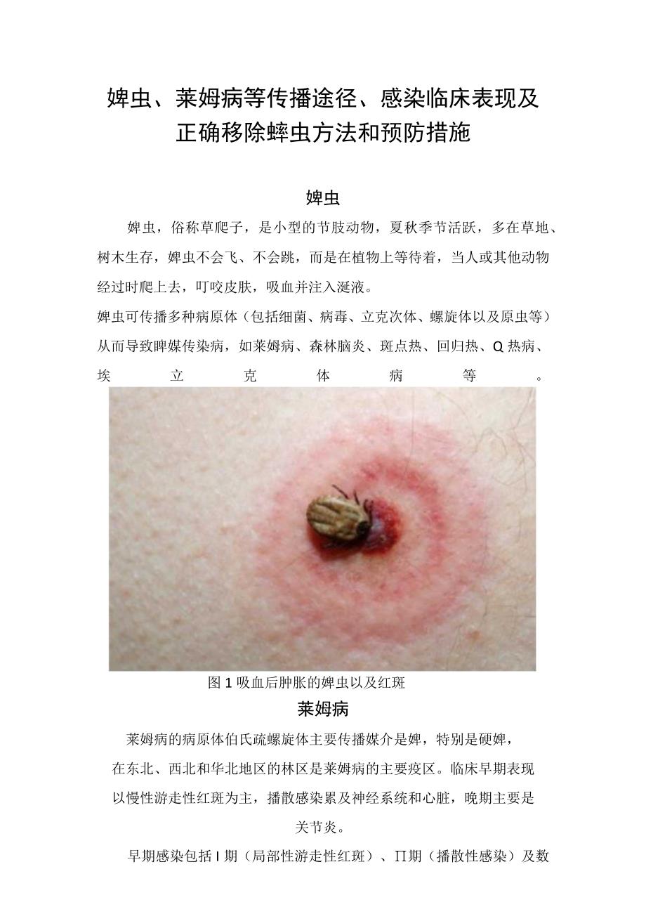 蜱虫莱姆病等传播途径感染临床表现及正确移除蜱虫方法和预防措施.docx_第1页