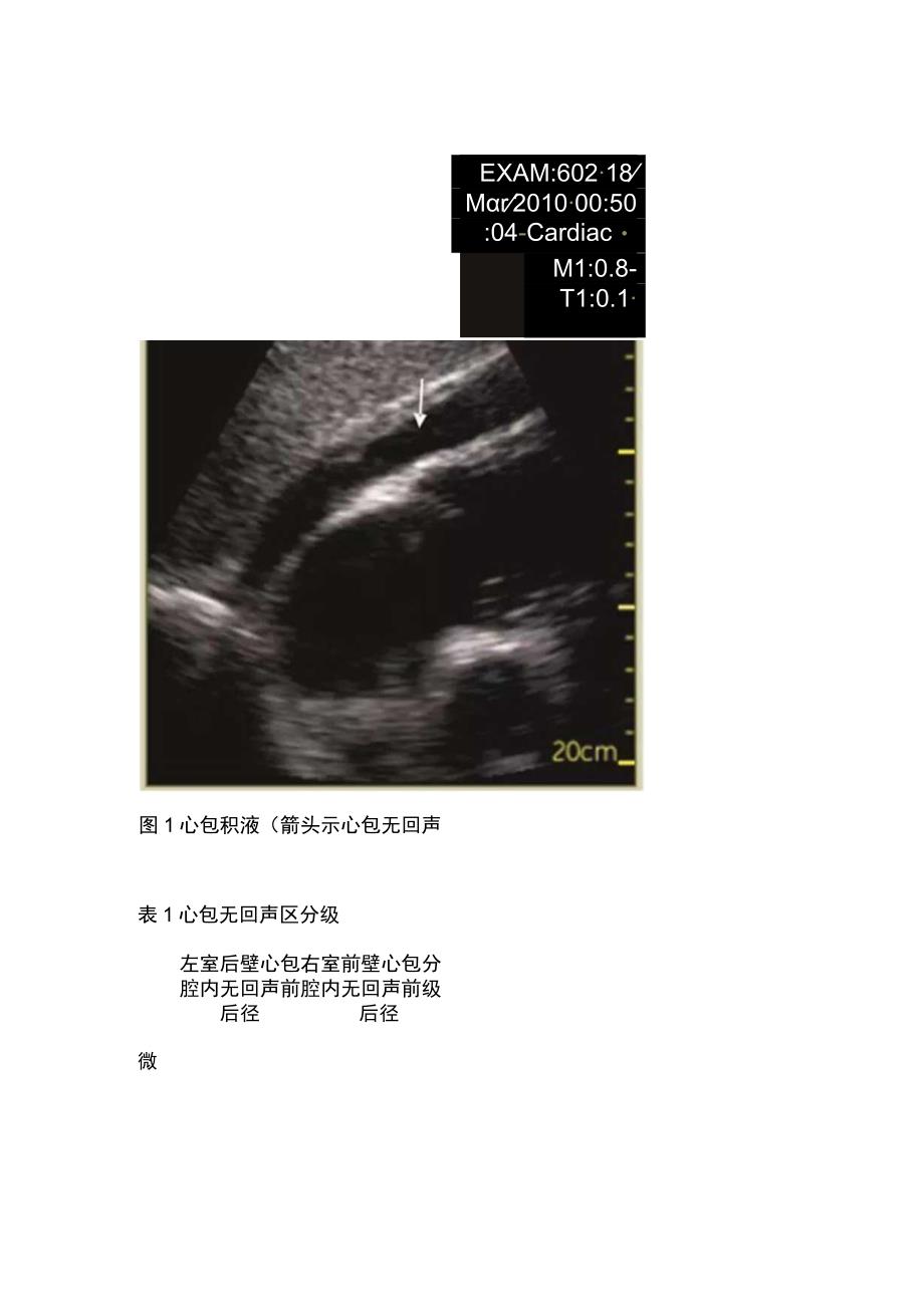 2023床旁超声在急危重症临床应用的专家共识完整版.docx_第2页