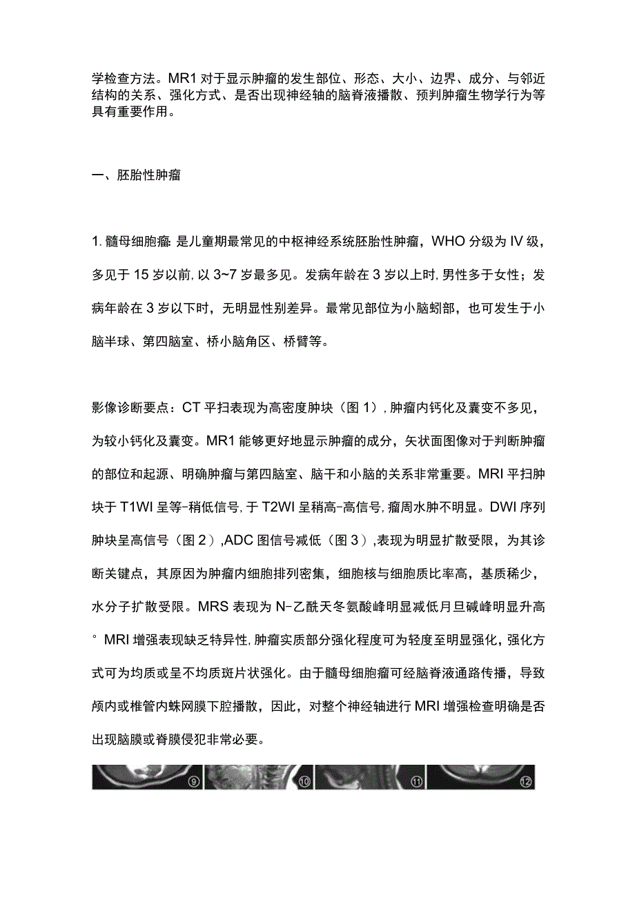 2023儿童后颅窝肿瘤的影像学诊断思路.docx_第2页