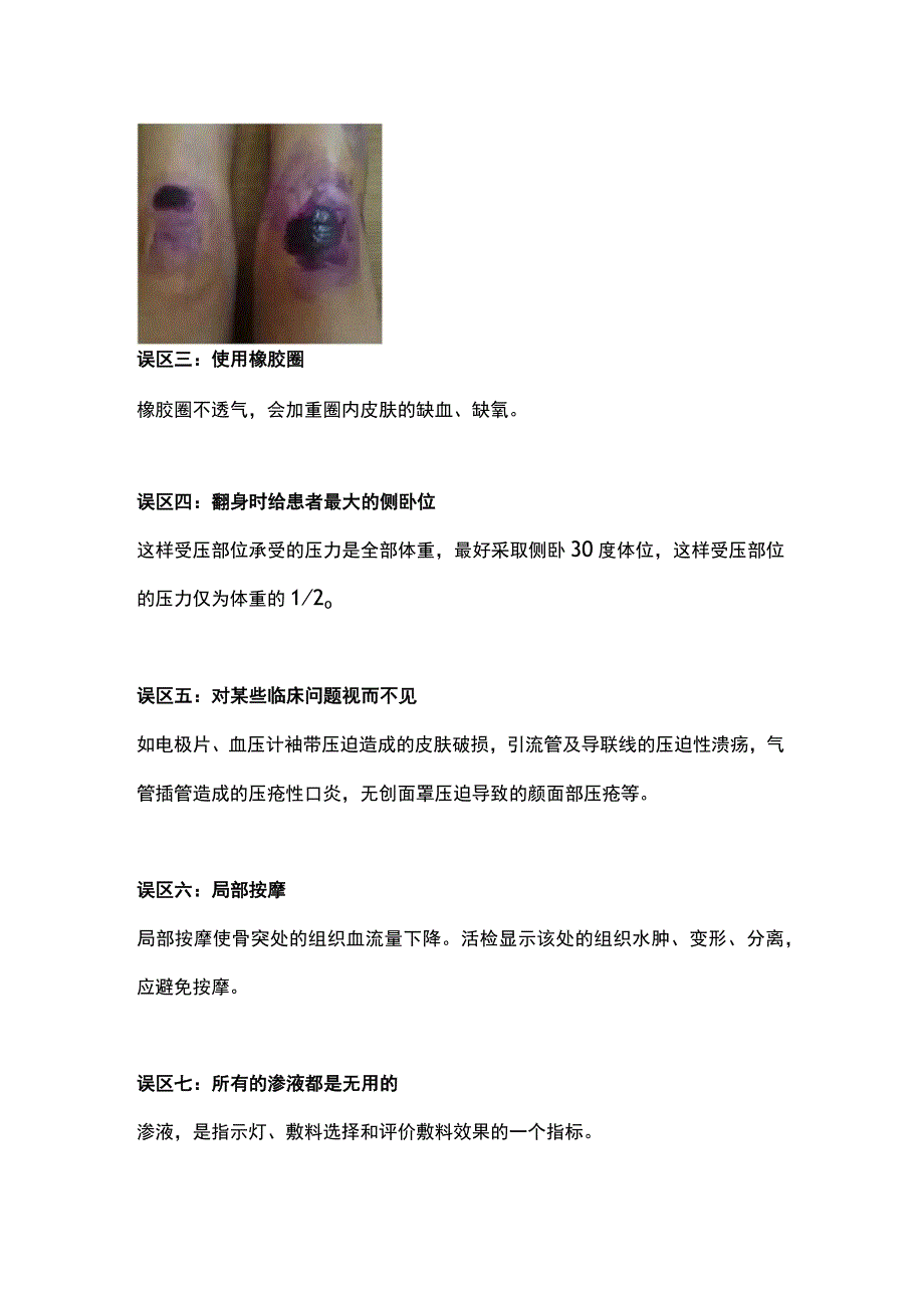 2023压疮护理的误区.docx_第2页