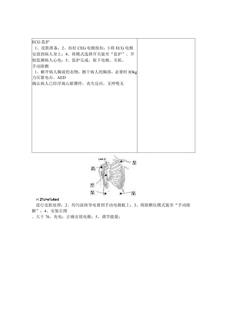 心电图的操作规程.docx_第2页