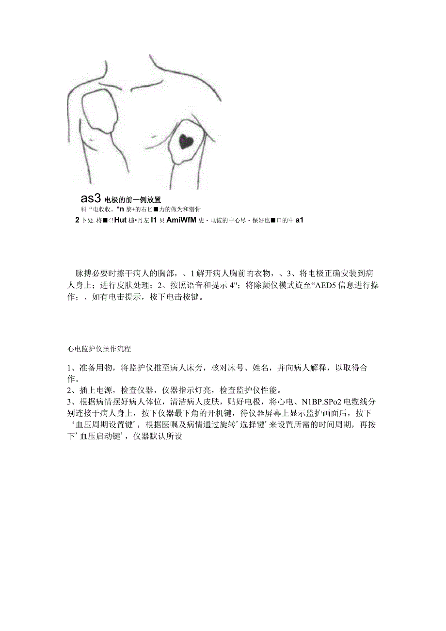 心电图的操作规程.docx_第3页