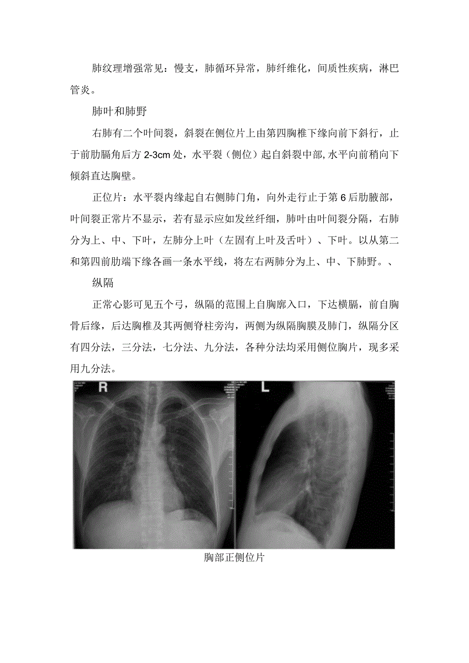 临床胸廓肺门肺纹理肺叶纵隔肺叶等肺部正常 X线表现及大叶性肺炎支气管肺炎过敏性肺炎化脓性肺炎肺结核婴幼儿肺炎.docx_第3页