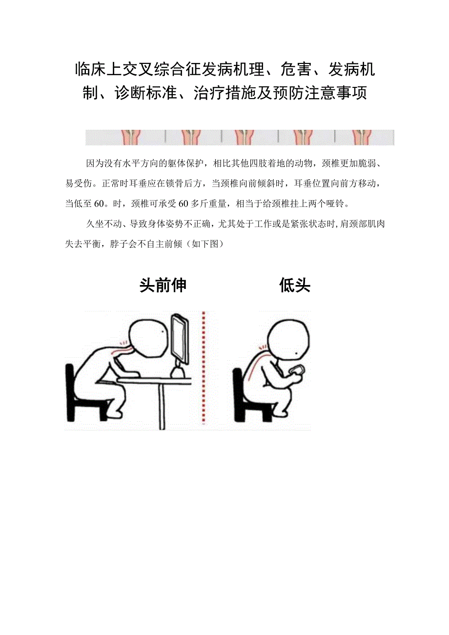 临床上交叉综合征发病机理危害发病机制诊断标准治疗措施及预防注意事项.docx_第1页