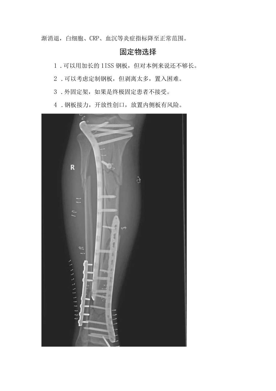 胫腓骨多段开放性骨折案例分享固定物选择固定技术要点术后创面及术后复查.docx_第2页