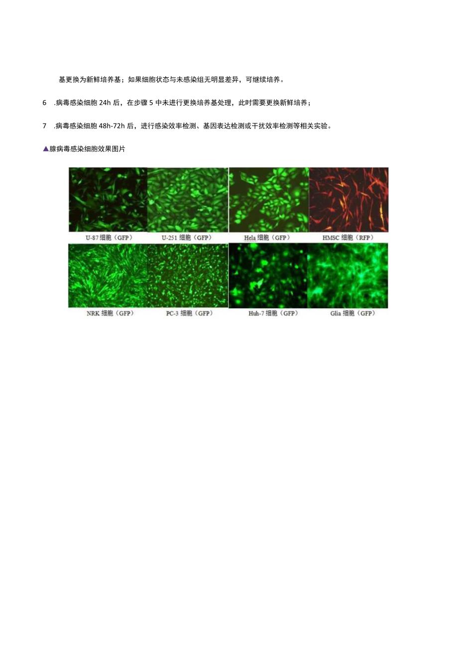 腺病毒产品使用说明书.docx_第2页