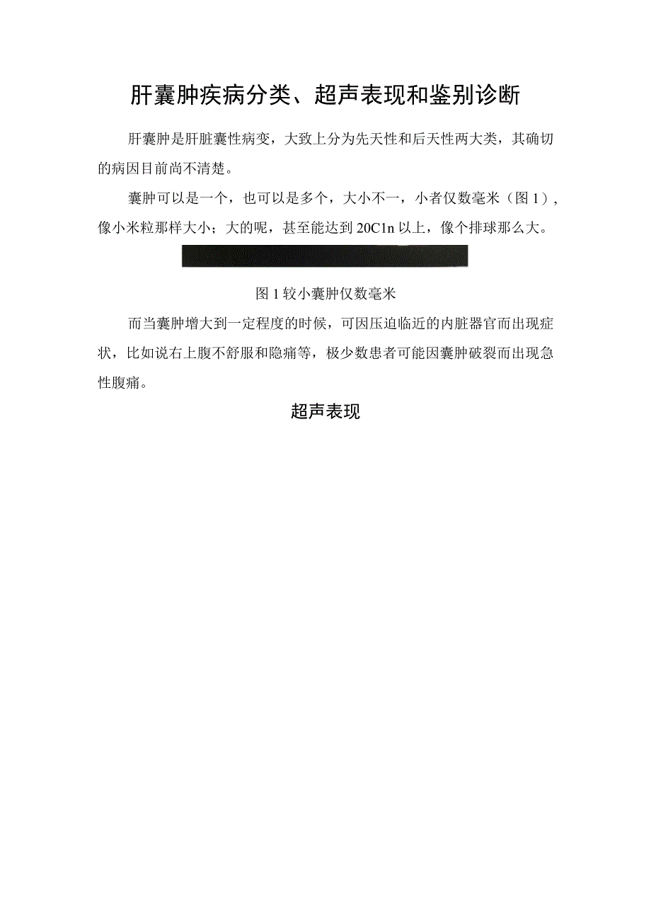 肝囊肿疾病分类超声表现和鉴别诊断.docx_第1页