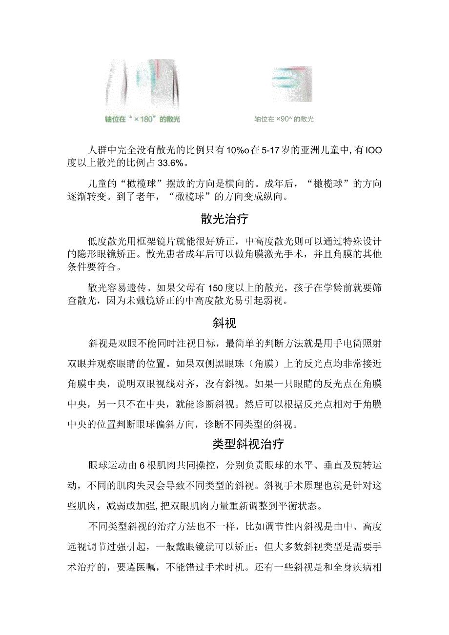 散光和斜视发病机制临床表现及治疗措施.docx_第2页