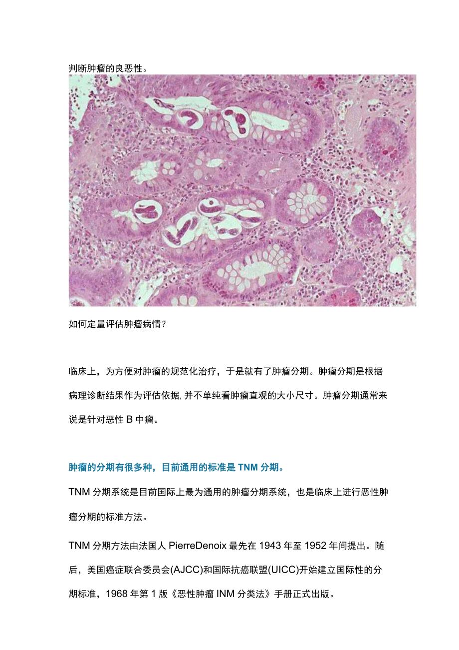 2023肿瘤病理分期TNM分期.docx_第2页