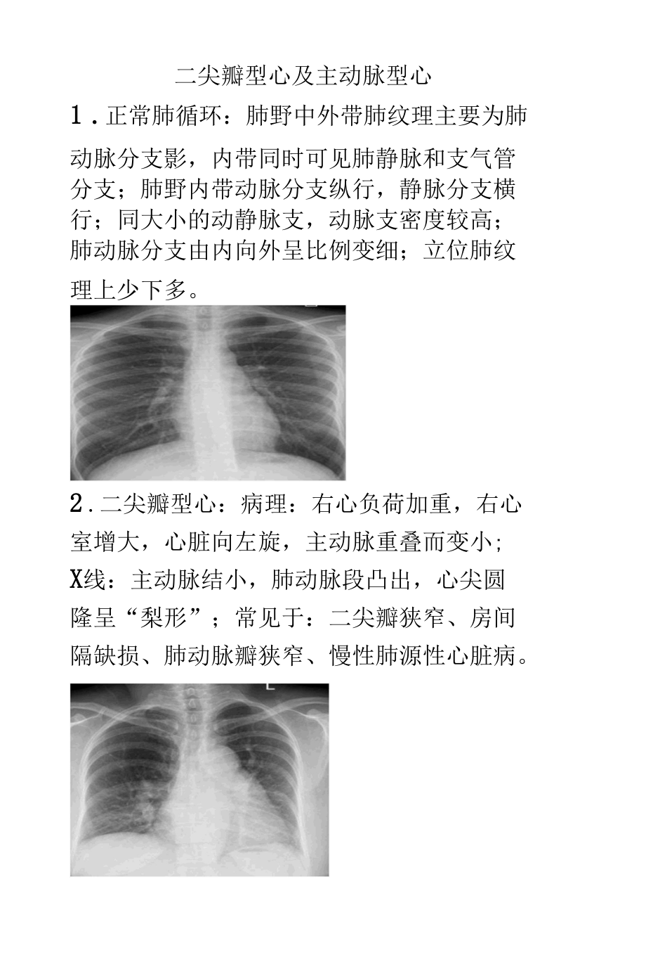 二尖瓣型心及主动脉型心影像诊断.docx_第1页