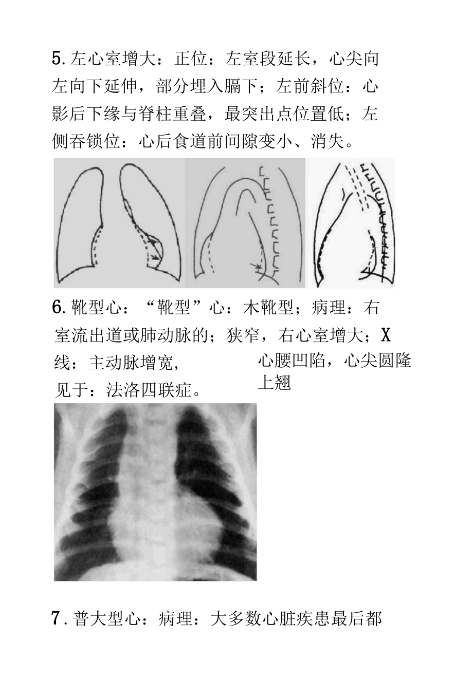 二尖瓣型心及主动脉型心影像诊断.docx_第3页